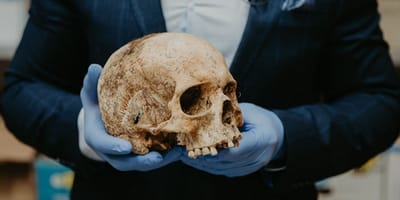 Human skull