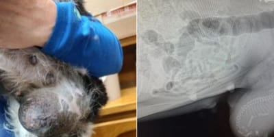 Suka ze stwardnieniem na brzuchu