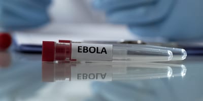 Laborröhrchen mit Aufschrift "Ebola"