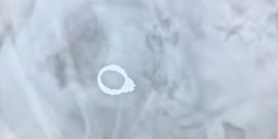 Une bague dans l'estomac d'un chien