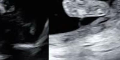 An ultrasound scan