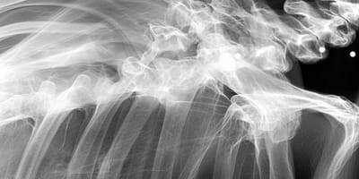 A dog's X-ray
