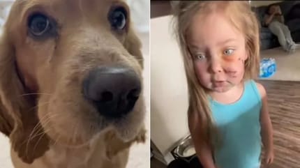 Kleines Mädchen von Familienhund gebissen