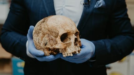 Human skull