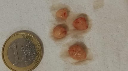 piedras en vejiga de gato