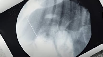 Röntgenbild des Hundes