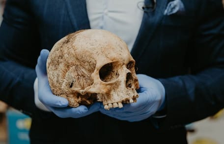Human skull