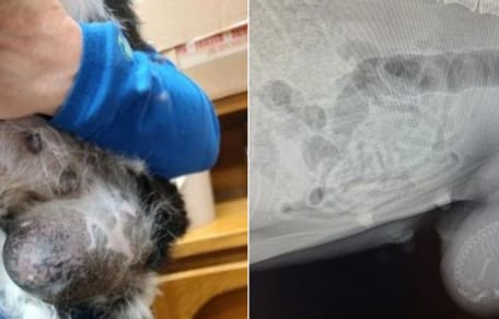 Suka ze stwardnieniem na brzuchu
