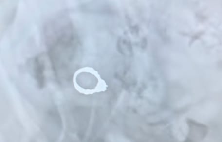 Une bague dans l'estomac d'un chien
