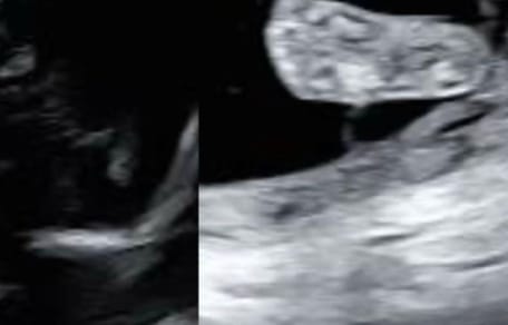 An ultrasound scan