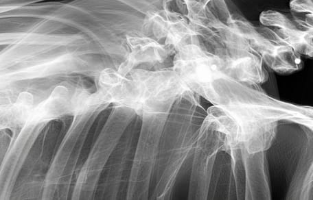A dog's X-ray