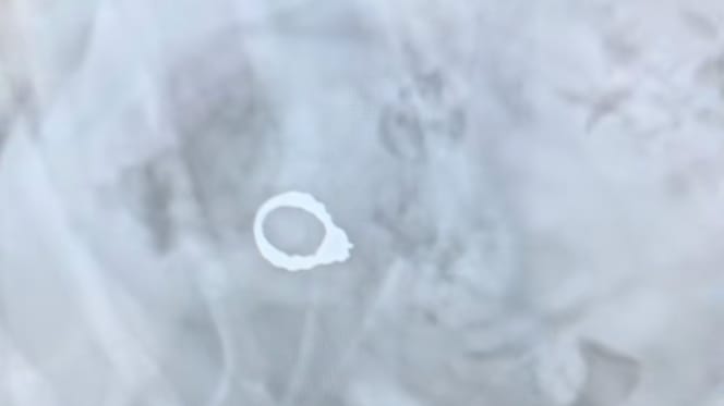 Ein Ring im Magen eines Hundes