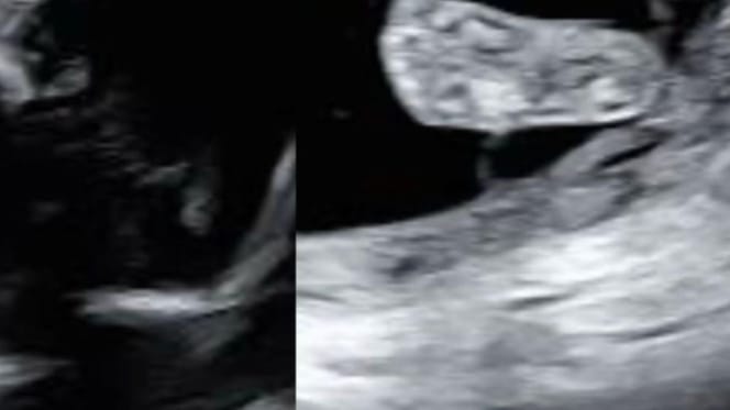 An ultrasound scan