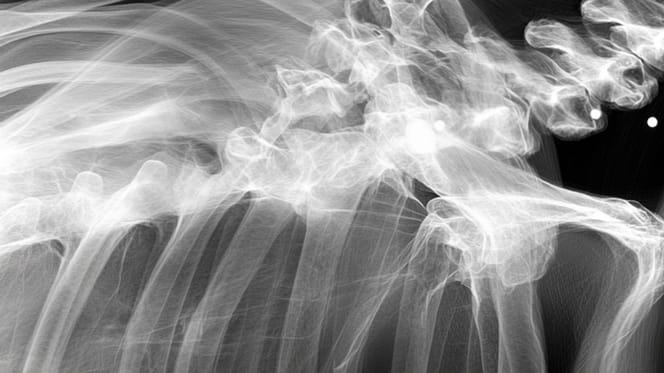 A dog's X-ray
