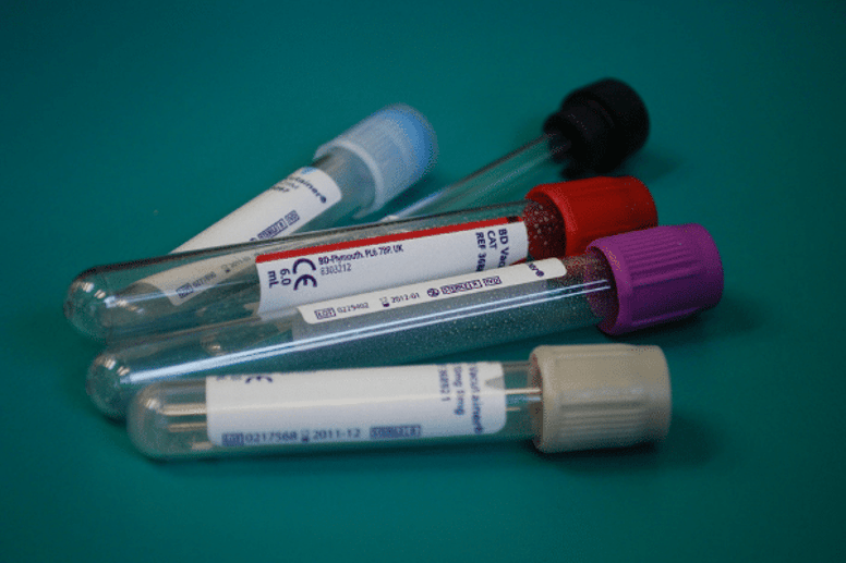 blood tests