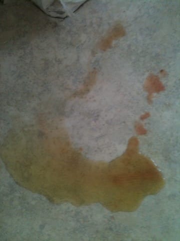 Sang dans l urine