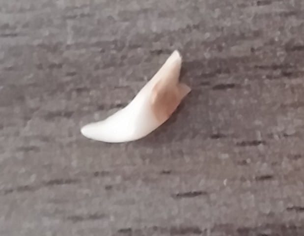 Premiere dent tombé