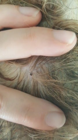 Matière noire sous la peau