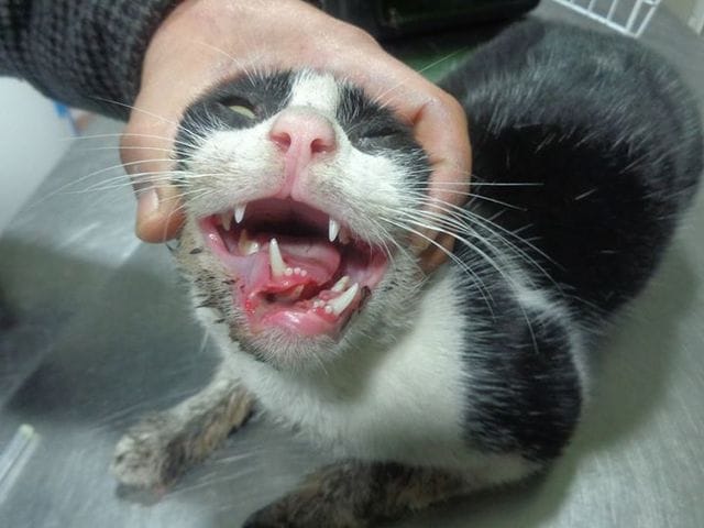 Fracture de la mâchoire inférieure (Mandibule)