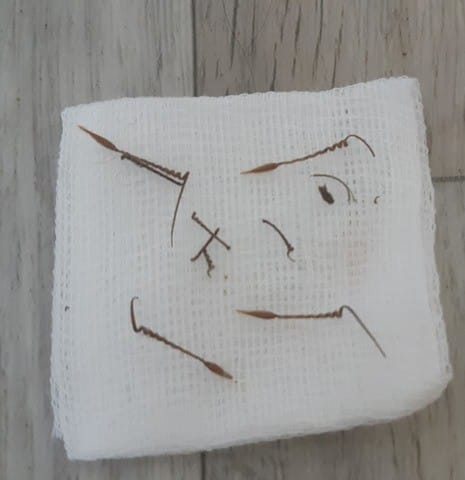 Sortes d’épillets de forme particulière au niveau des pattes