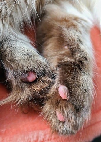 Pelle dei polpastrelli che si stacca