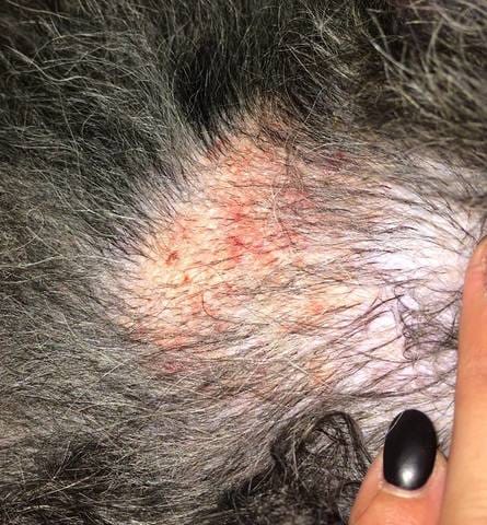 Rougeures sur l'intérieure de la cuisse