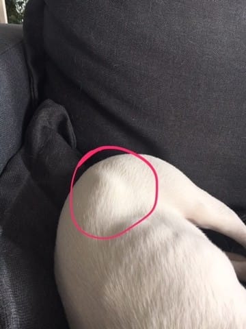 Boule dure sur la fesse