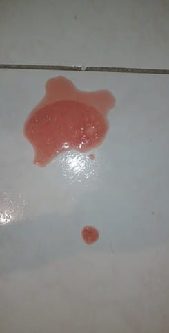 Mon chat vomit du liquide rouge avec de la mousse !