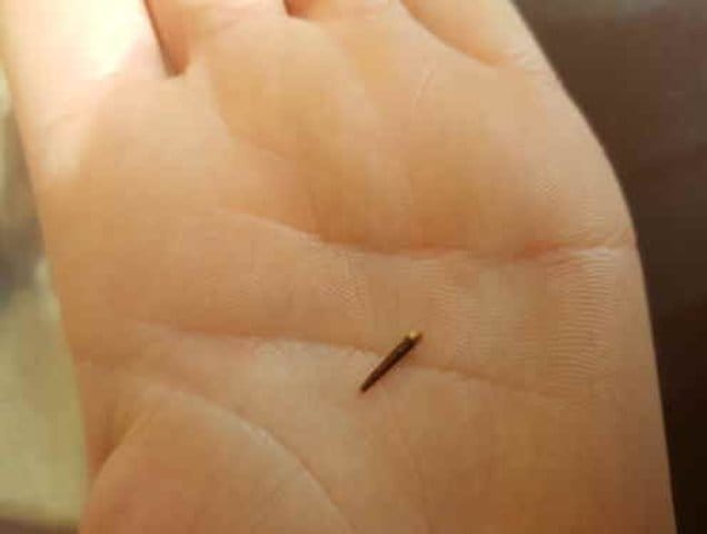 Quelles peuvent être les raisons d'une boiterie après avoir enlevé une épine ?
