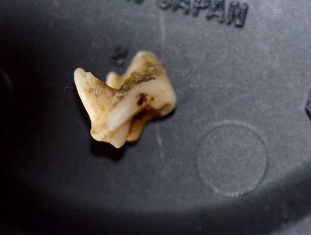 Ma chienne perd ses dents ?