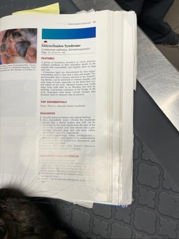 Ehlers-Danlos Syndrome