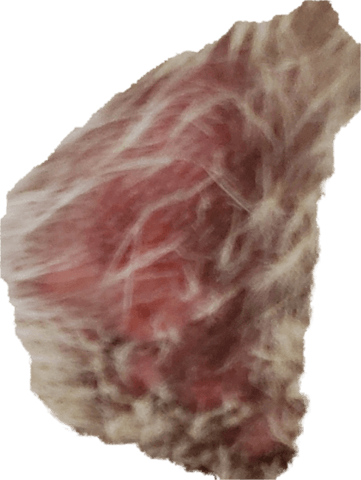 Problème de peau