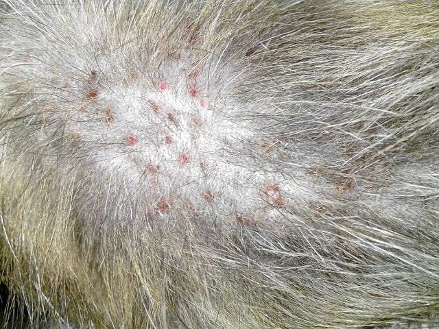 Boutons rouges douloureux sur le dos