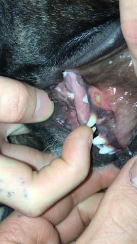 Entaille à la gencive