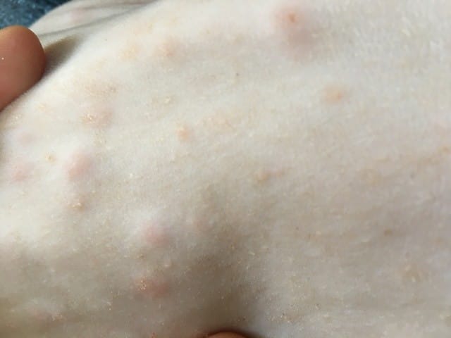 Boutons apparaissant sporadiquement