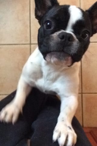 Post Op Ablation quand Fémur