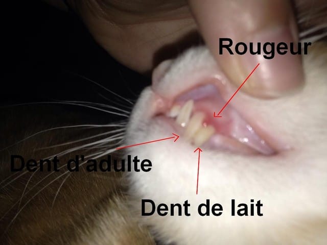 Gencive rouge + dent qui ne tombe pas