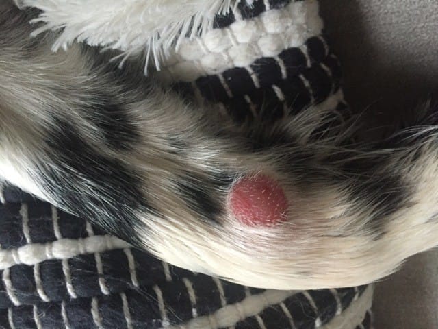 Boule de chair, lipome, tumeur...