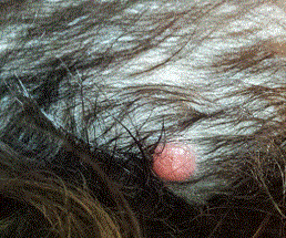 Boule rouge sur le ventre