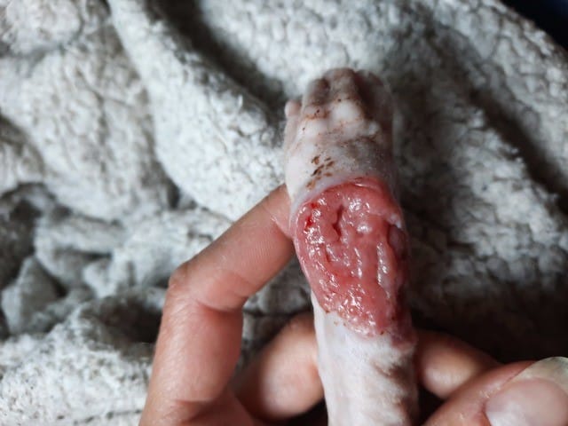 Plaie qui ne cicatrise pas et qui s'agrandie