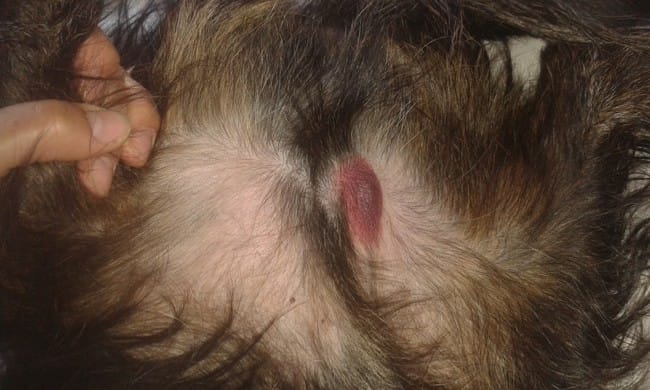 Boule au niveau de l'aine