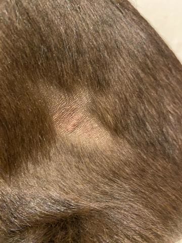 Eczema? Comment soigner?