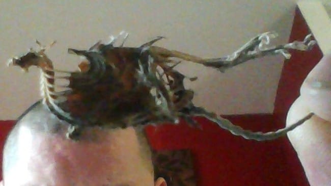 Identification squelette