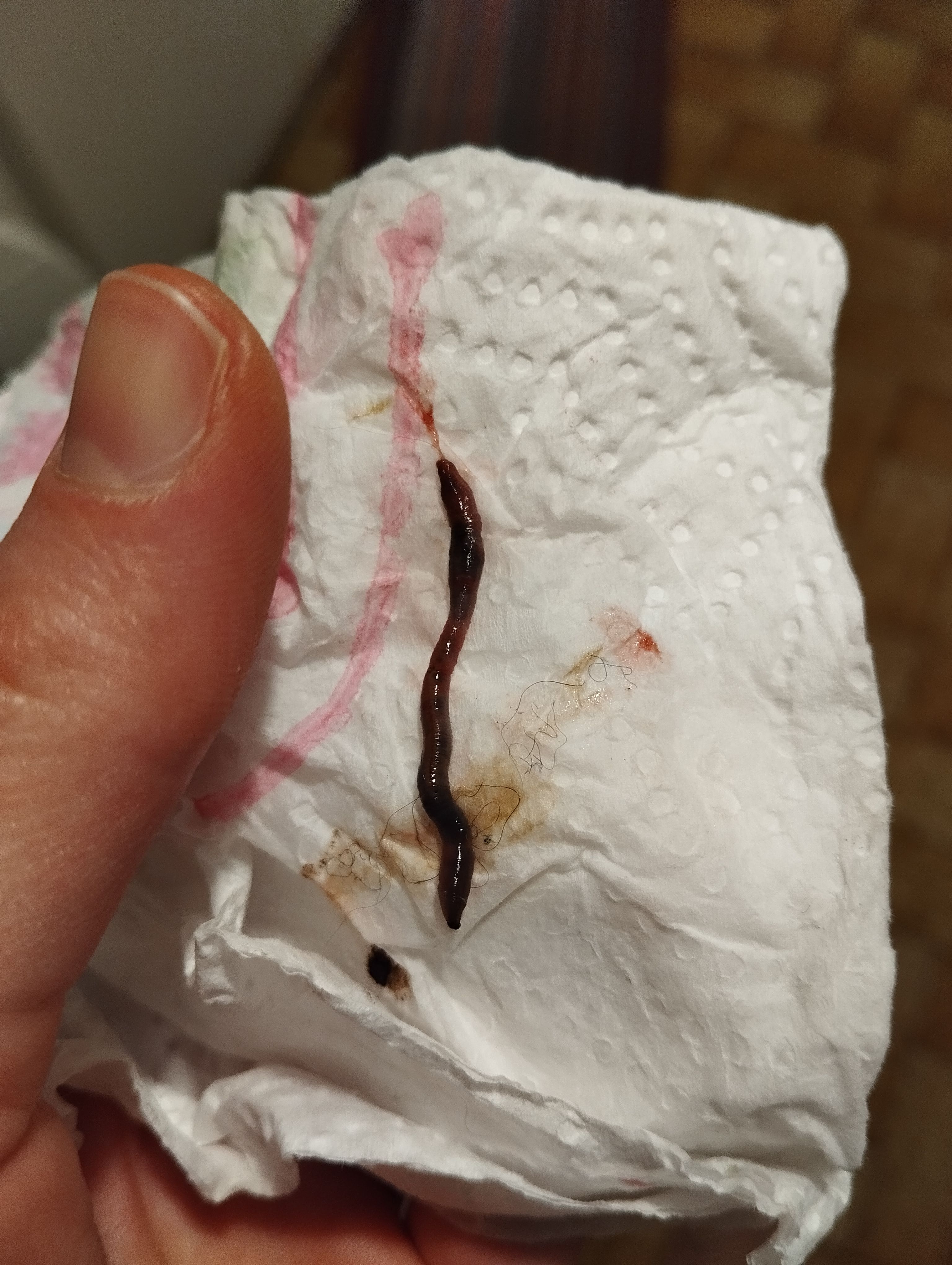 Ver ascaris ou ver de terre ?