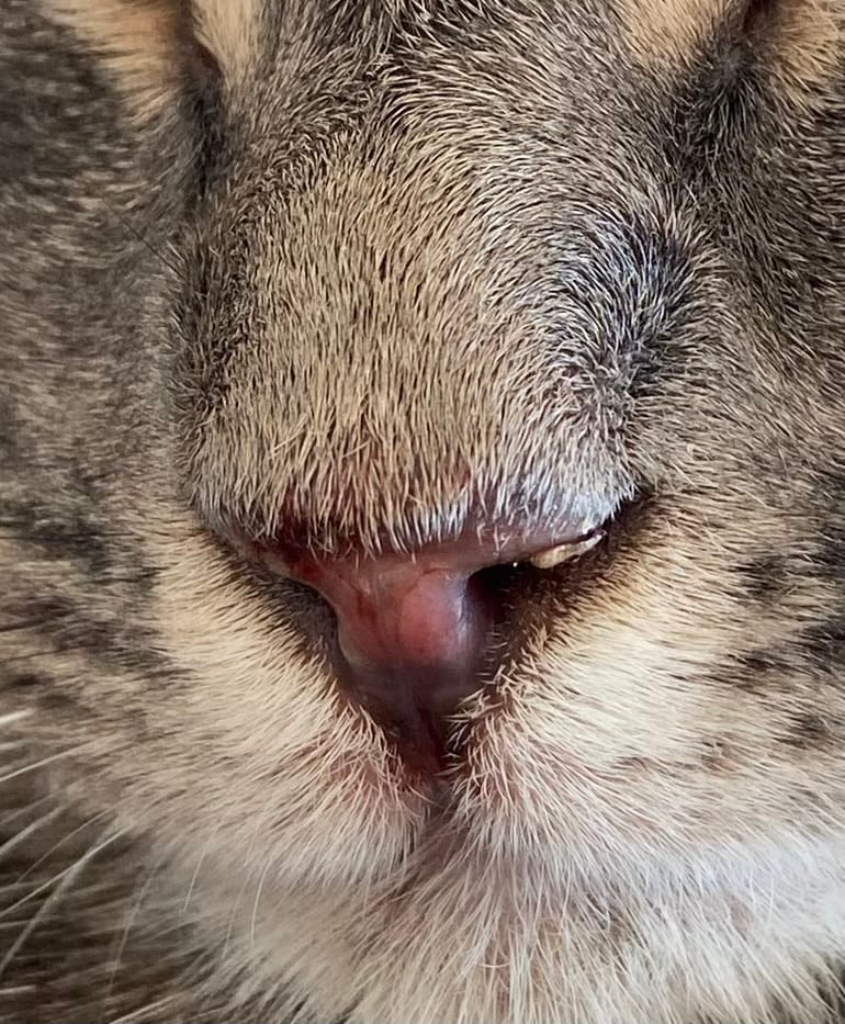 Blessure au nez comme si c’était brûlé