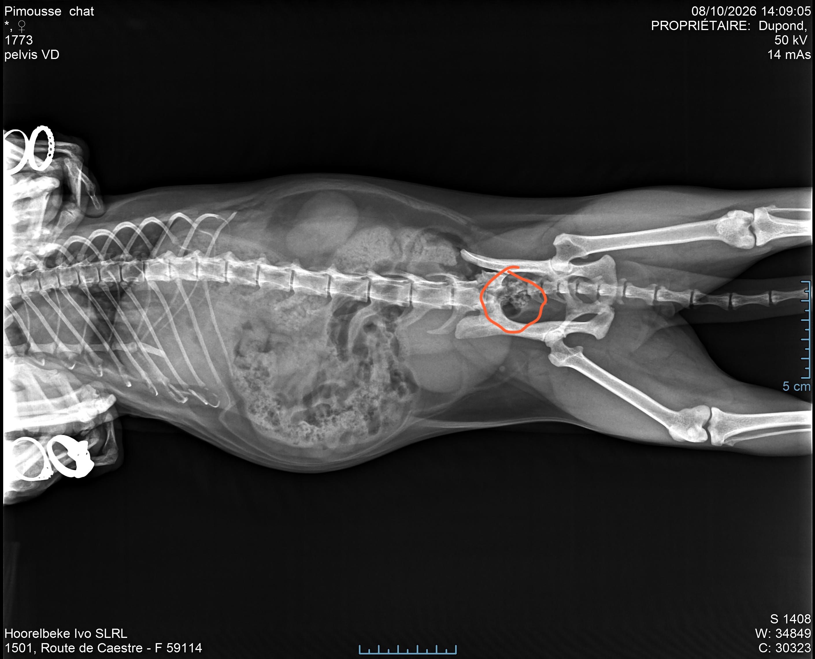 Radiologie et cancer