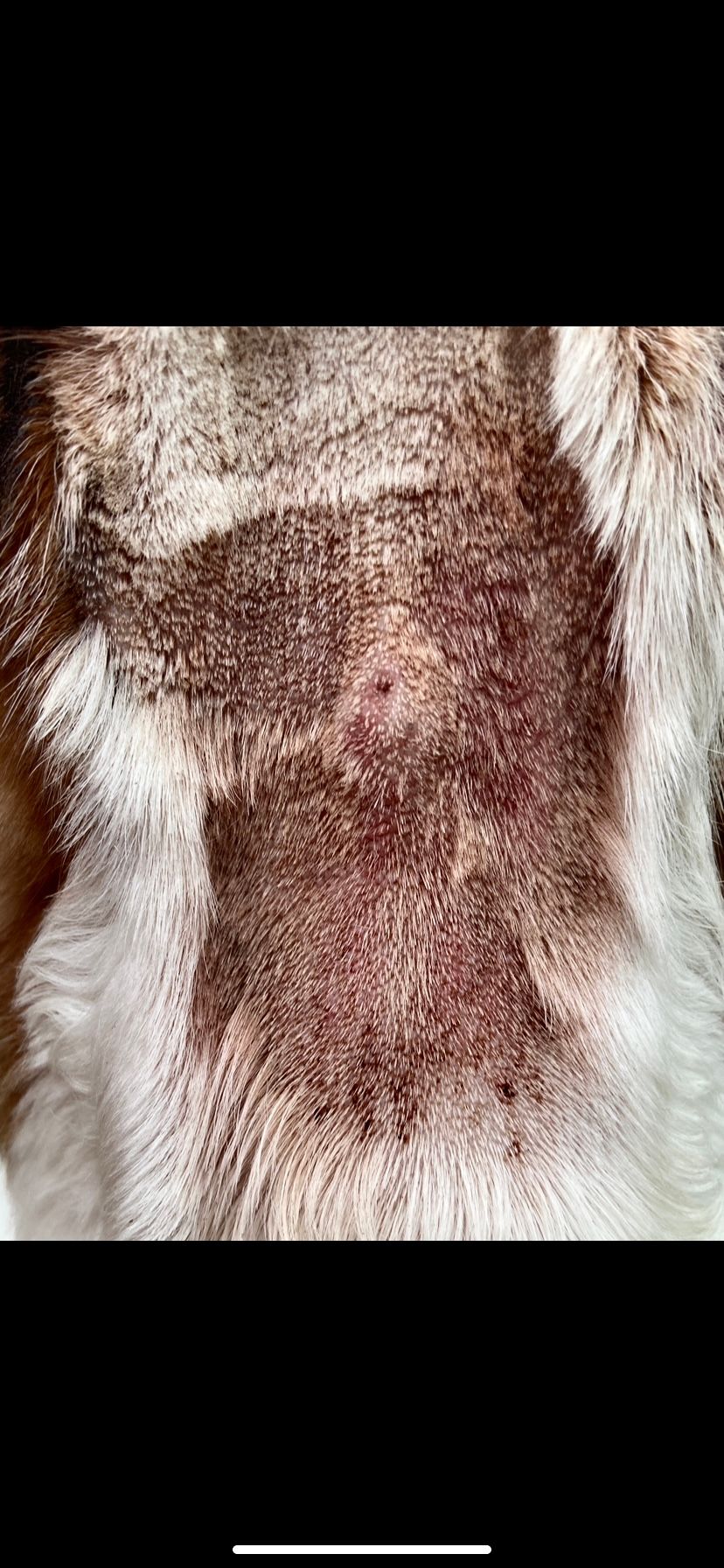 Dermatitis por Malassezia