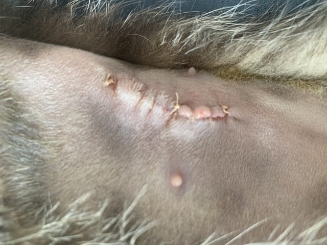 Cicatrice stérilisation