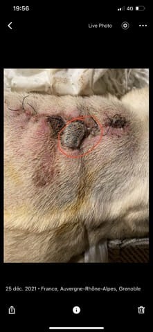 Aide anesthésie carlin abcès