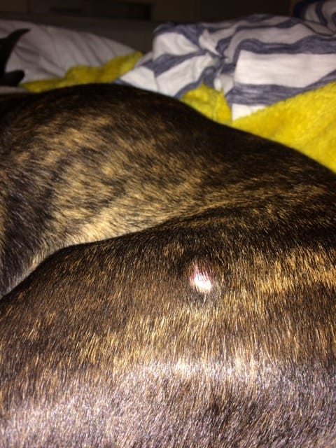 Boule qui grossit sous la peau